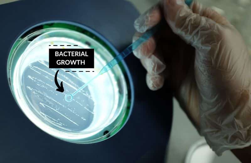 Legionella in petri dish